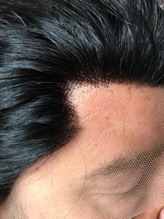  The hair line is plucked to make the shape that Elvis had his hair line with prominent temple hair